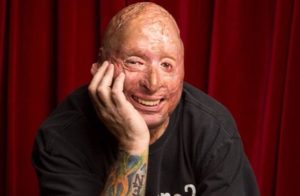 Bobby Henline in upcoming doc Live Well Done